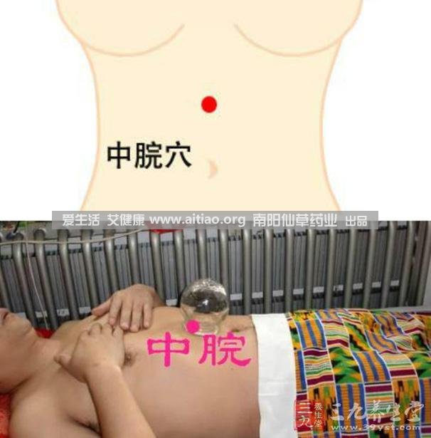 中脘穴位于腹部正中線(xiàn)，臍上4寸的位置上。每天艾灸10-15分鐘，能有效緩解胃部不適的癥狀，同時(shí)有助于祛濕。